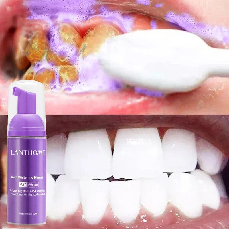 50ml V34 Mousse Toothpaste Teeth Whitening Removing Yellow Teeth Cleaning Tooth Stain Oral Fresh Tooth Care Product 2024 New